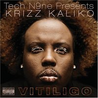 Krizz Kaliko, Vitiligo