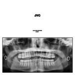 Jack Van Cleaf, JVC