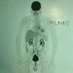 The Alarm, Transformation